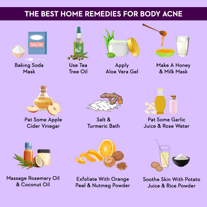 Home remedies for acne